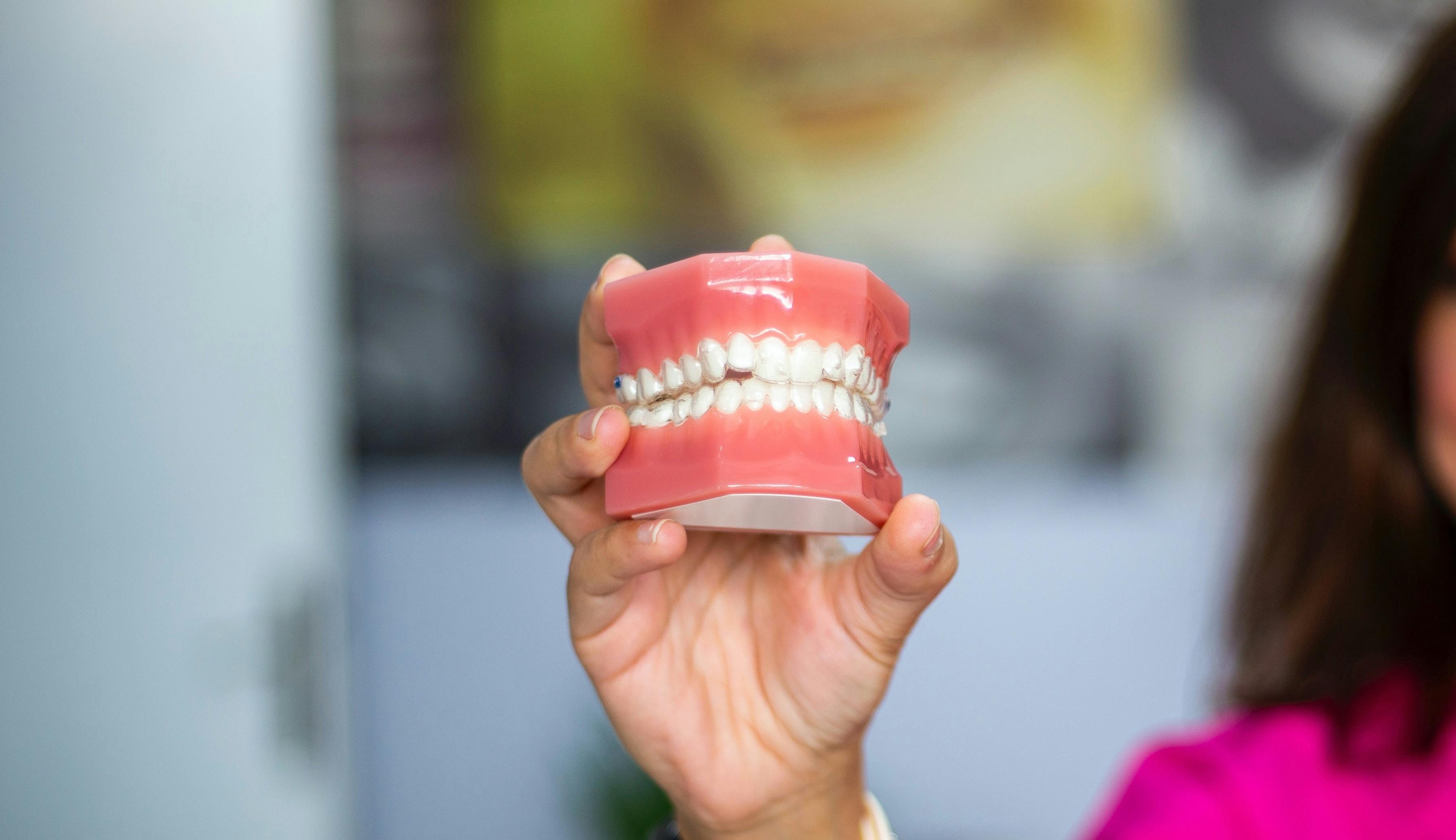 Dental Implants vs Dentures