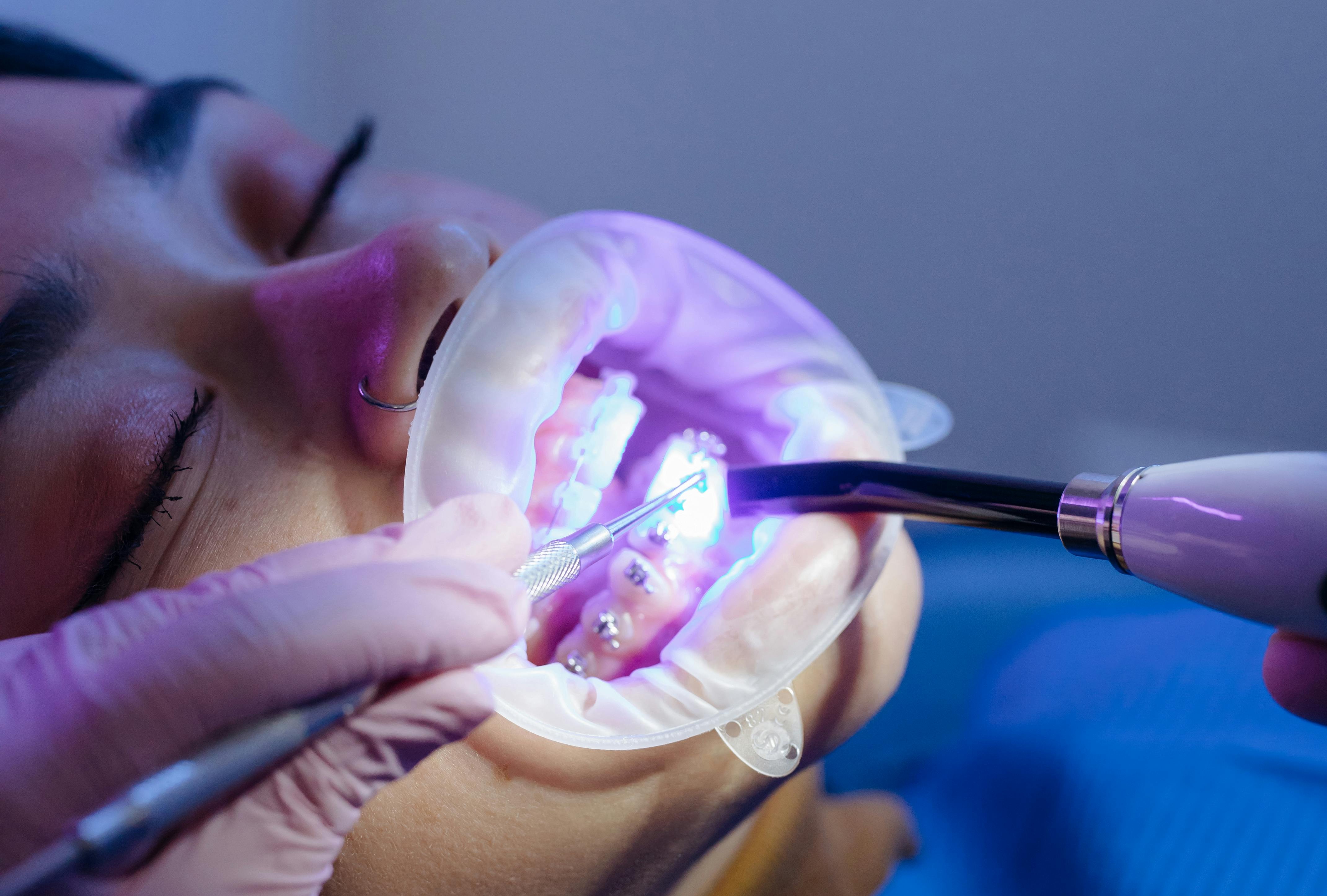 Laser Dentistry