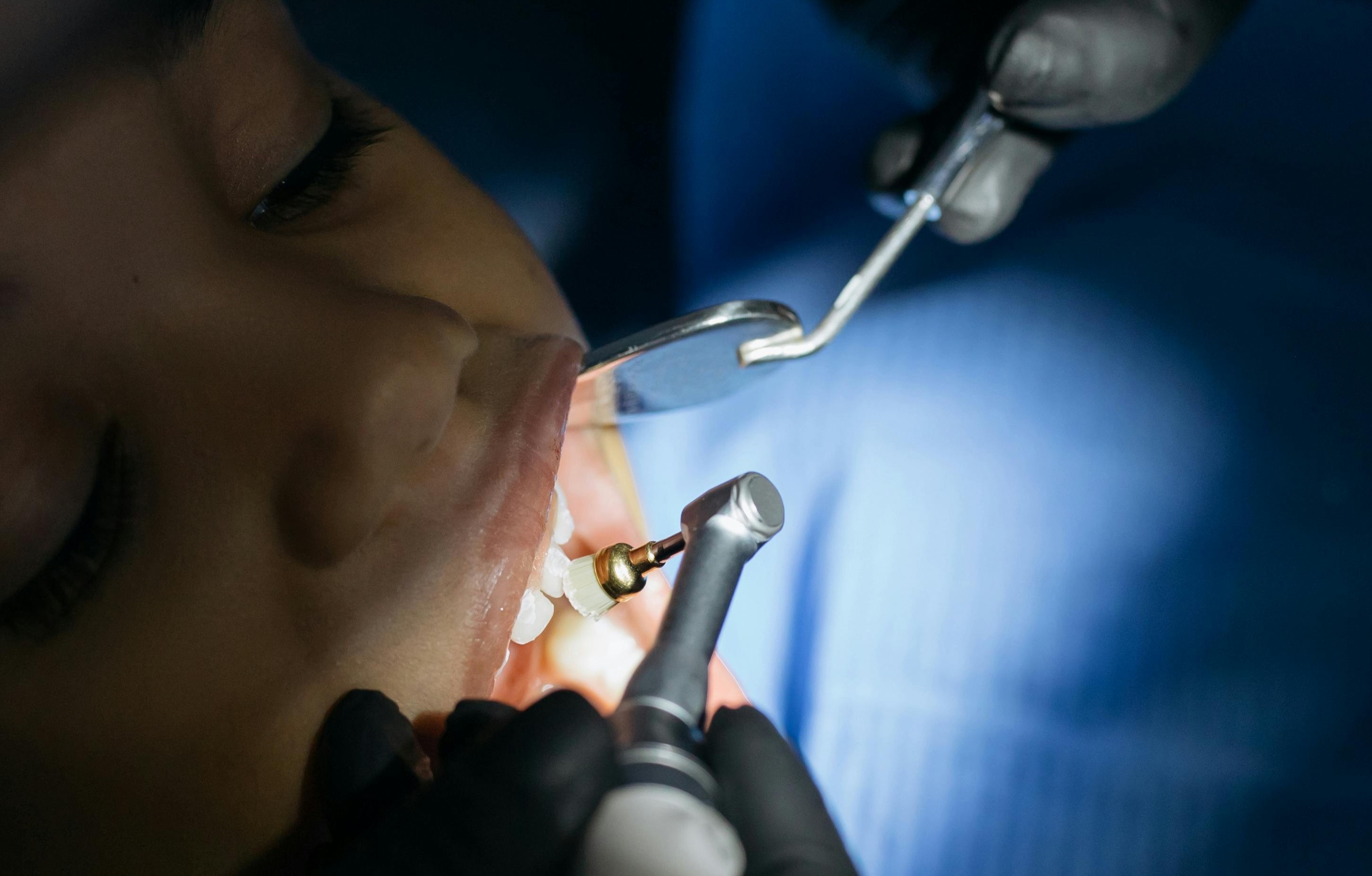 Dental Treatments