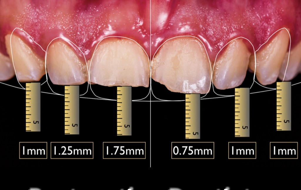 Restorative Dentistry