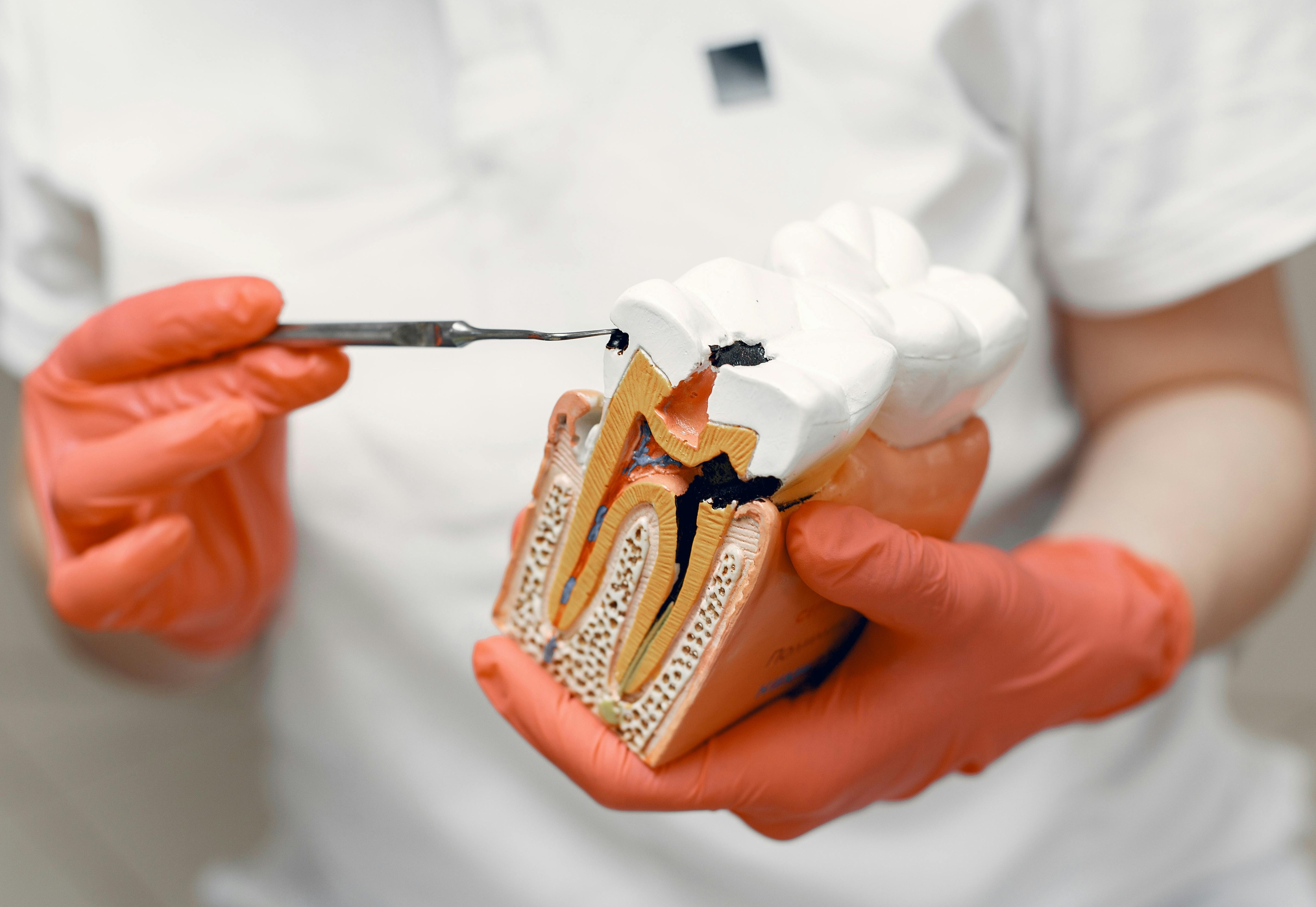 Root Canal Treatment